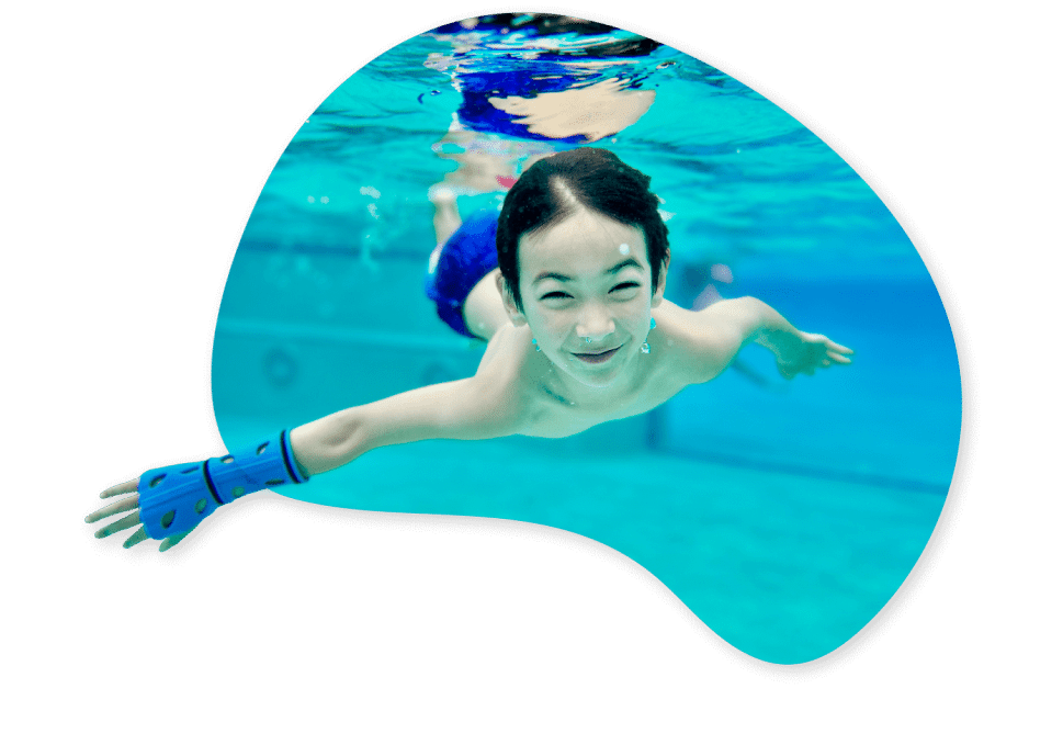 Young boy with a 3D printed cast on his arm swimming underwater