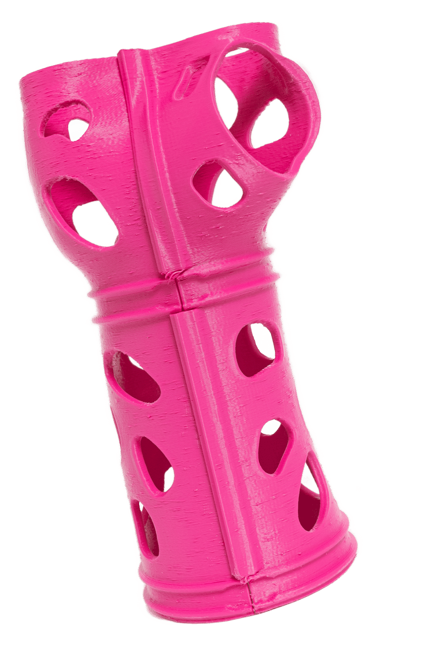 3D printed waterproof wrist cast in pink