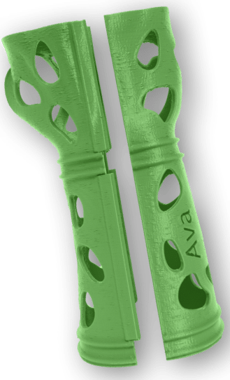 Green 3D printed cast by Dimension Ortho