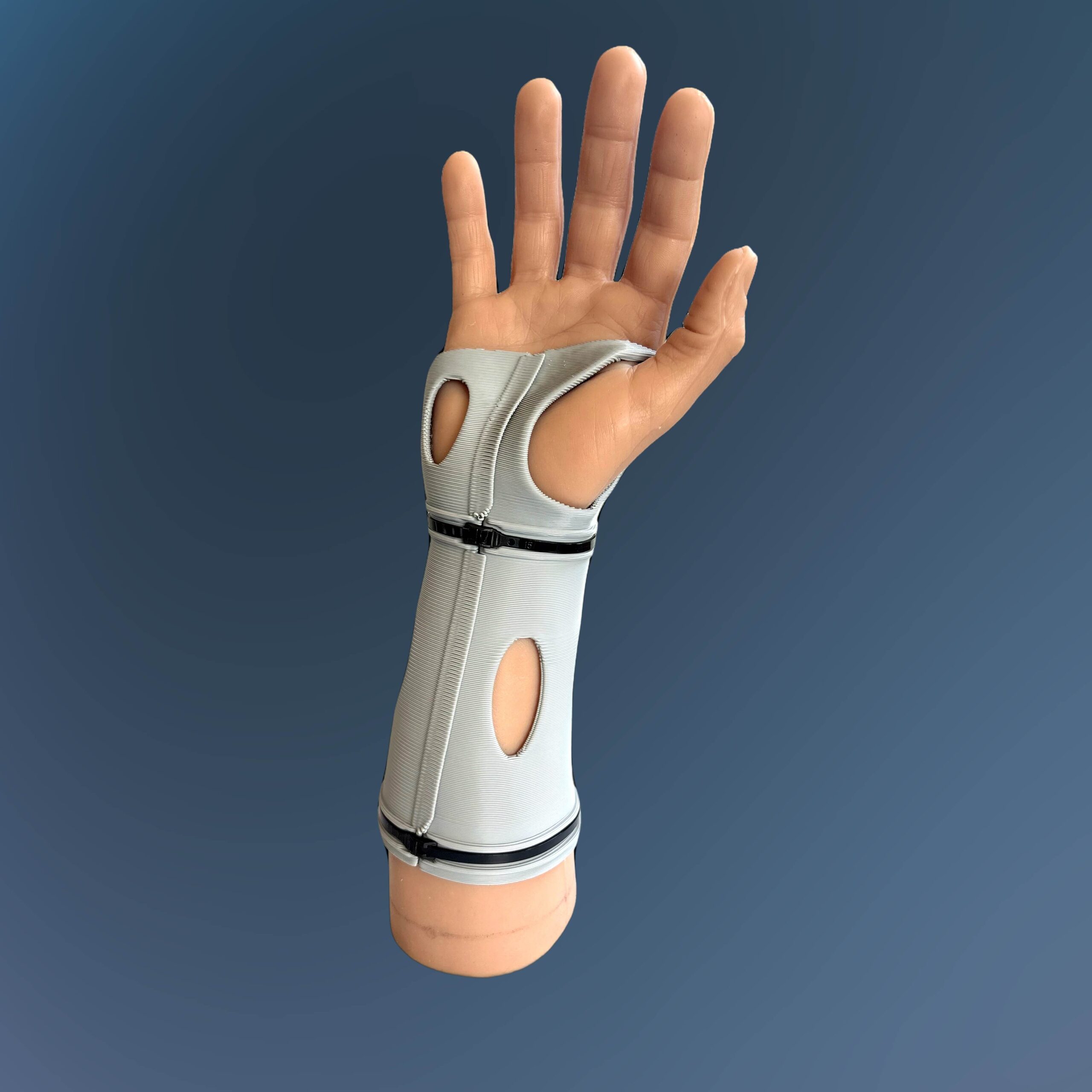 Model Hand Short Arm Cast 2