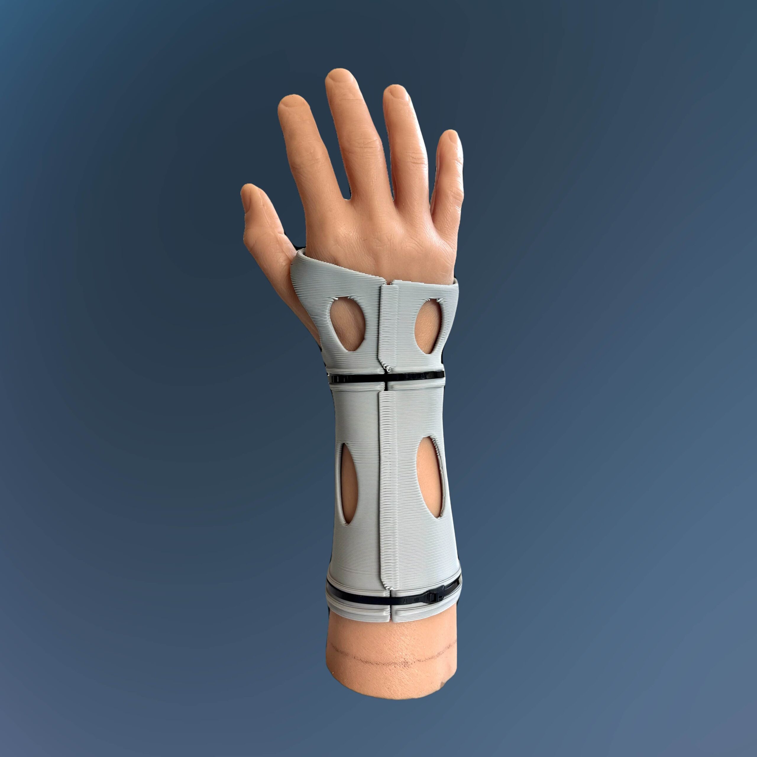Model Hand Short Arm Cast 3