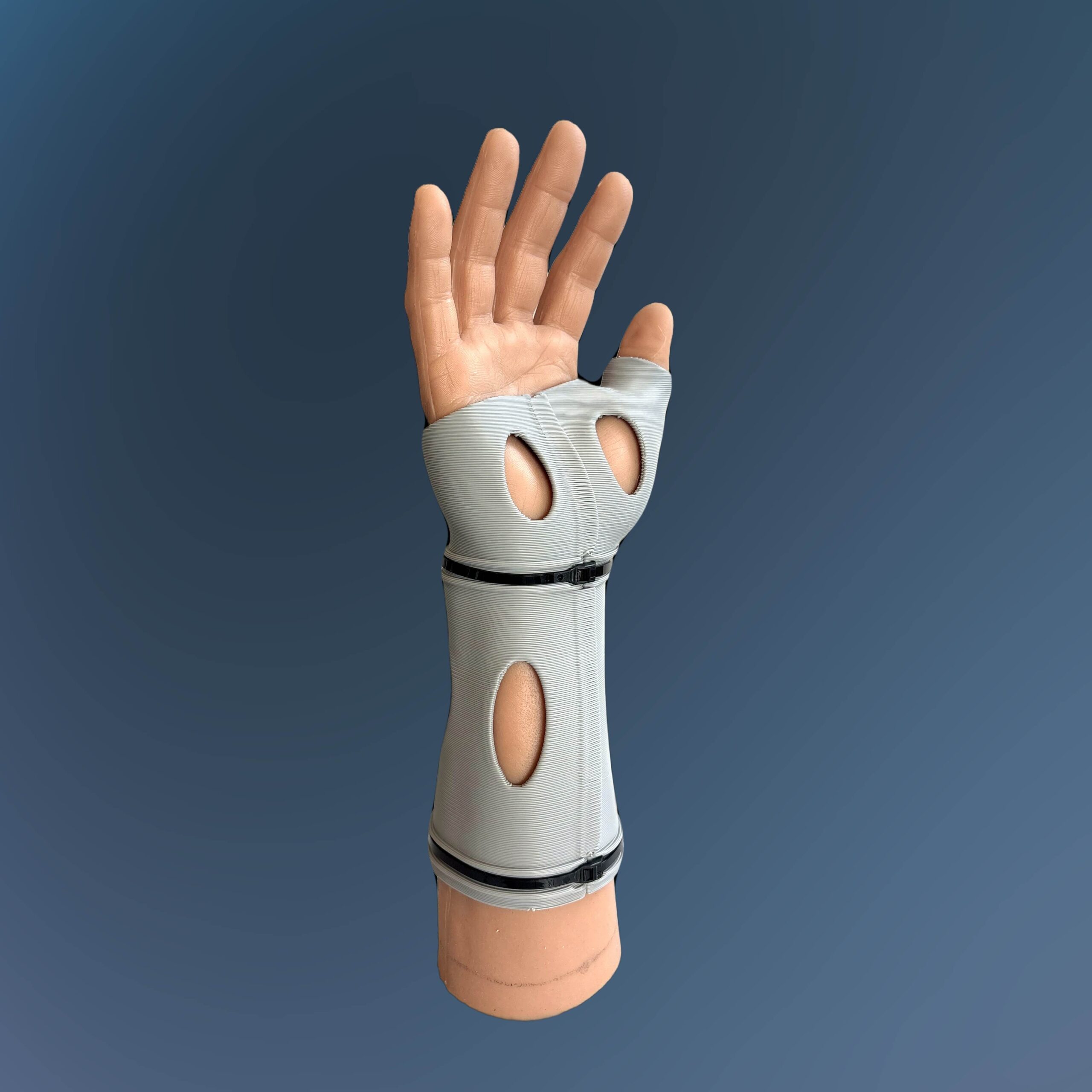 Model Hand Thumb Spica Cast 1