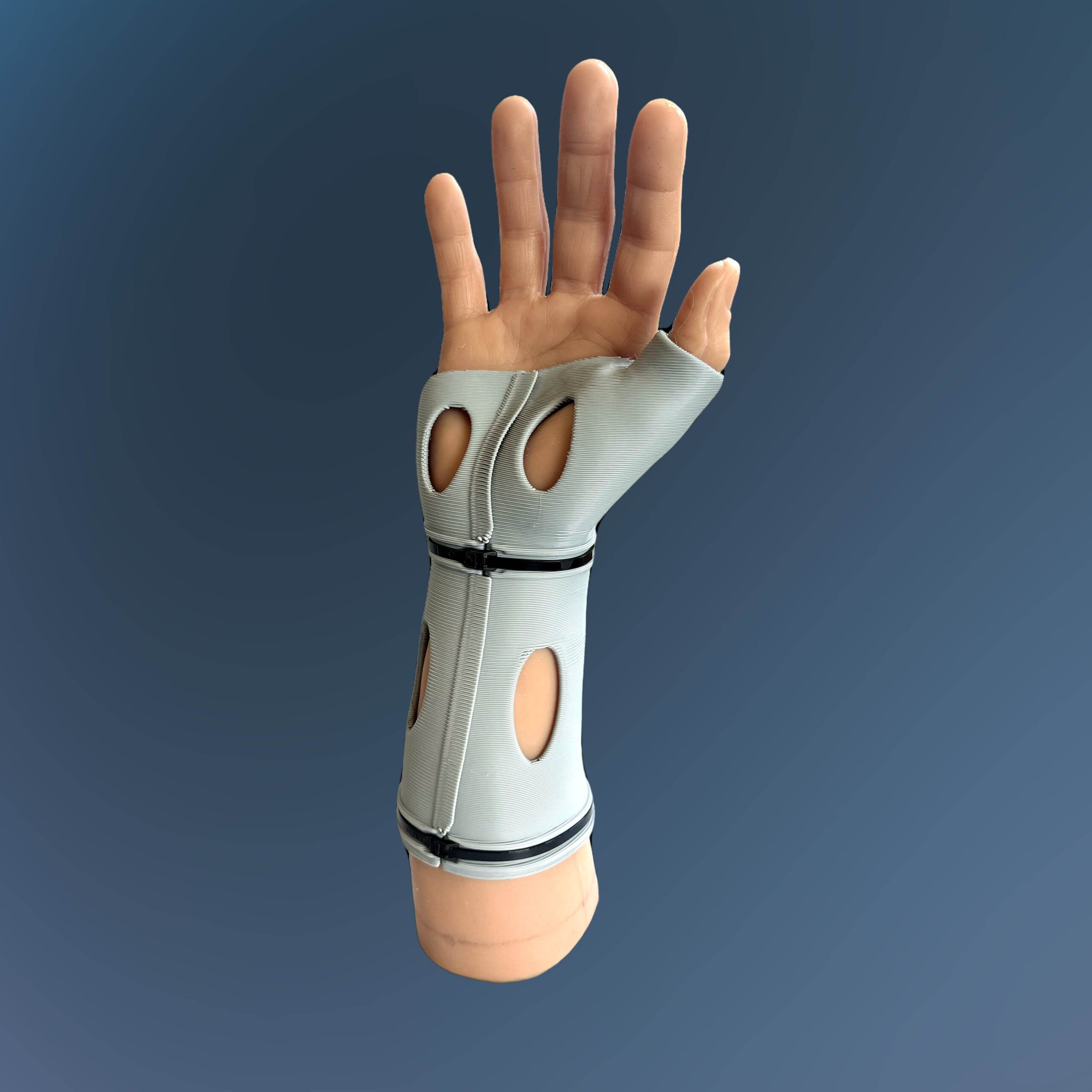 Model Hand Thumb Spica Cast 2