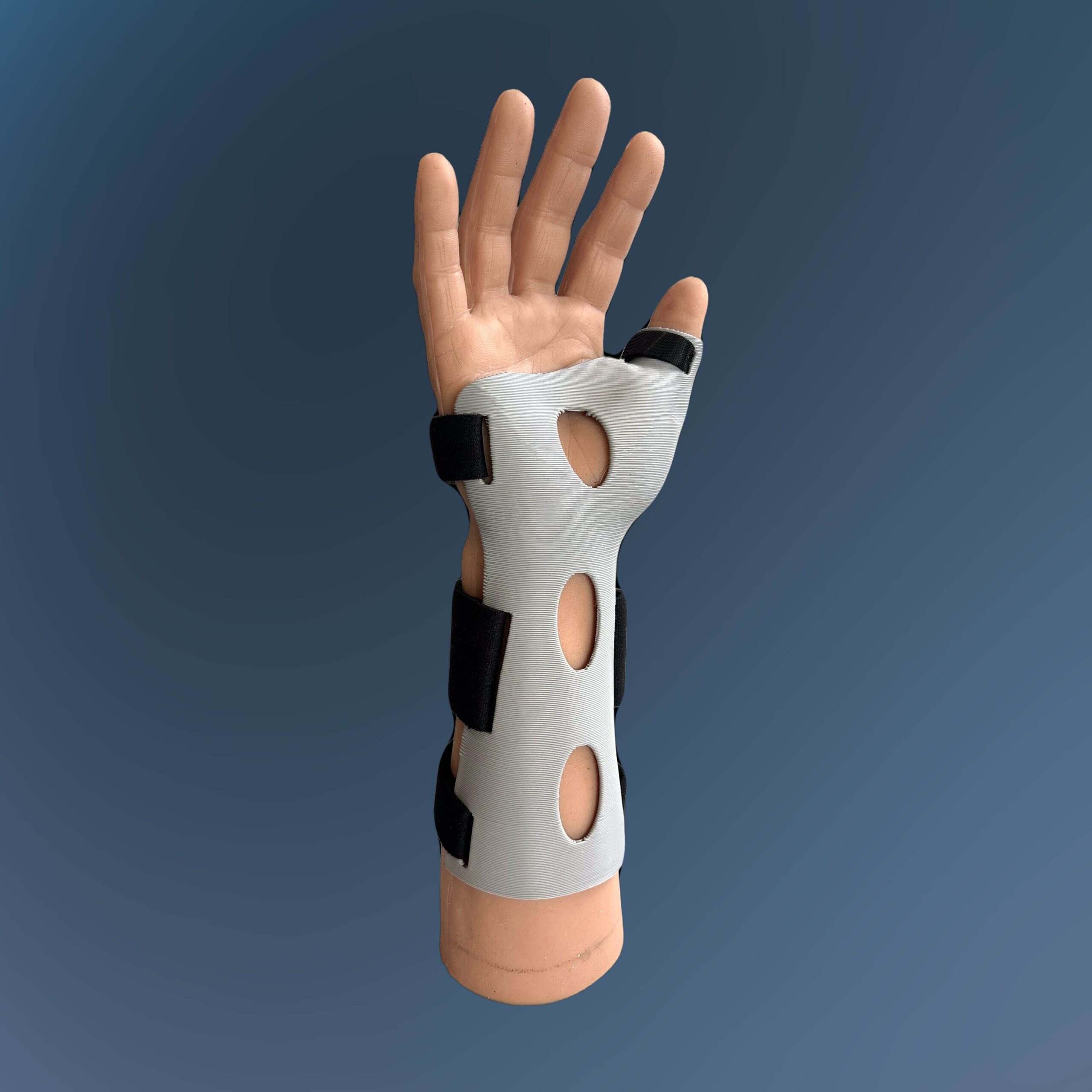 Model Hand Thumb Spica Forearm 1