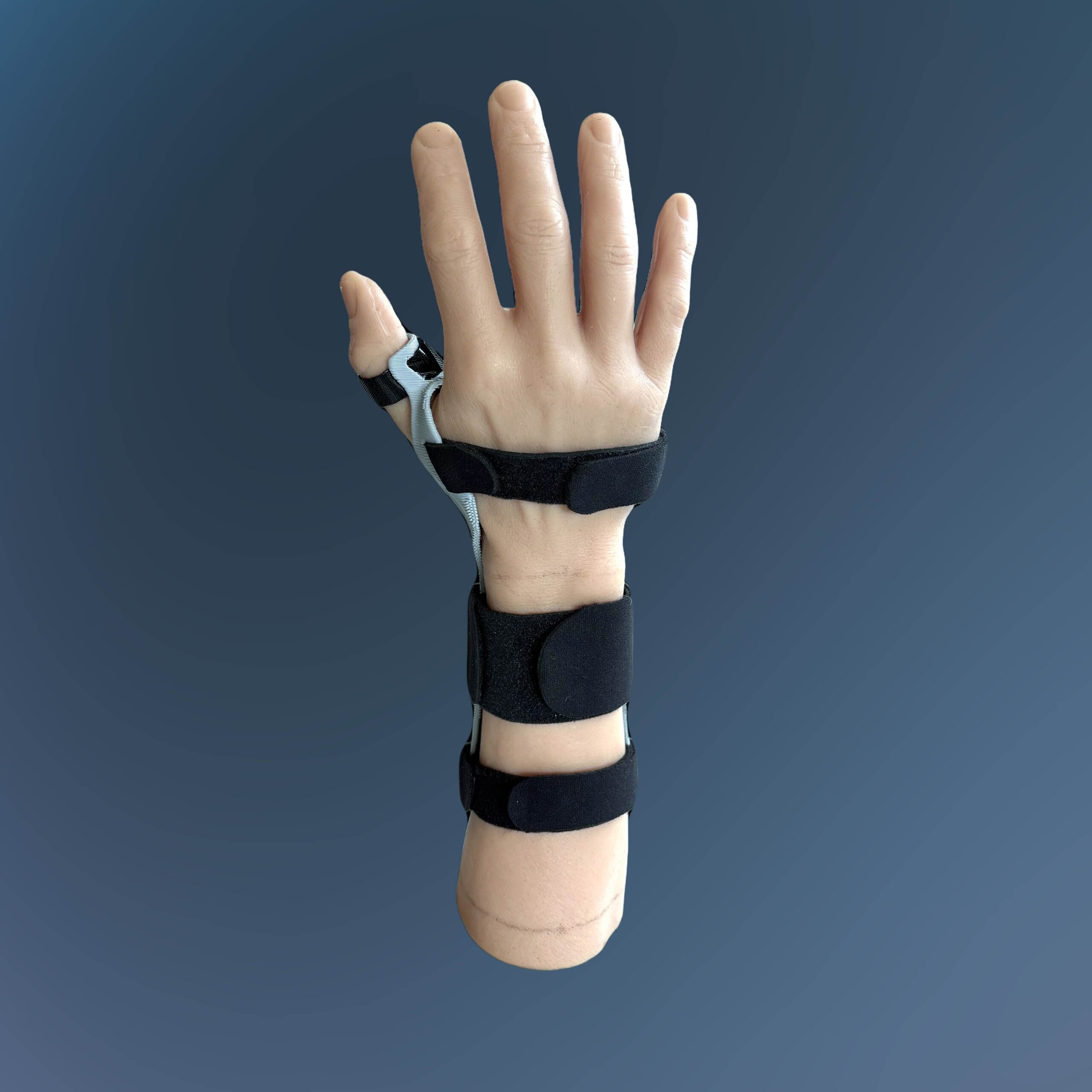 Model Hand Thumb Spica Forearm 3