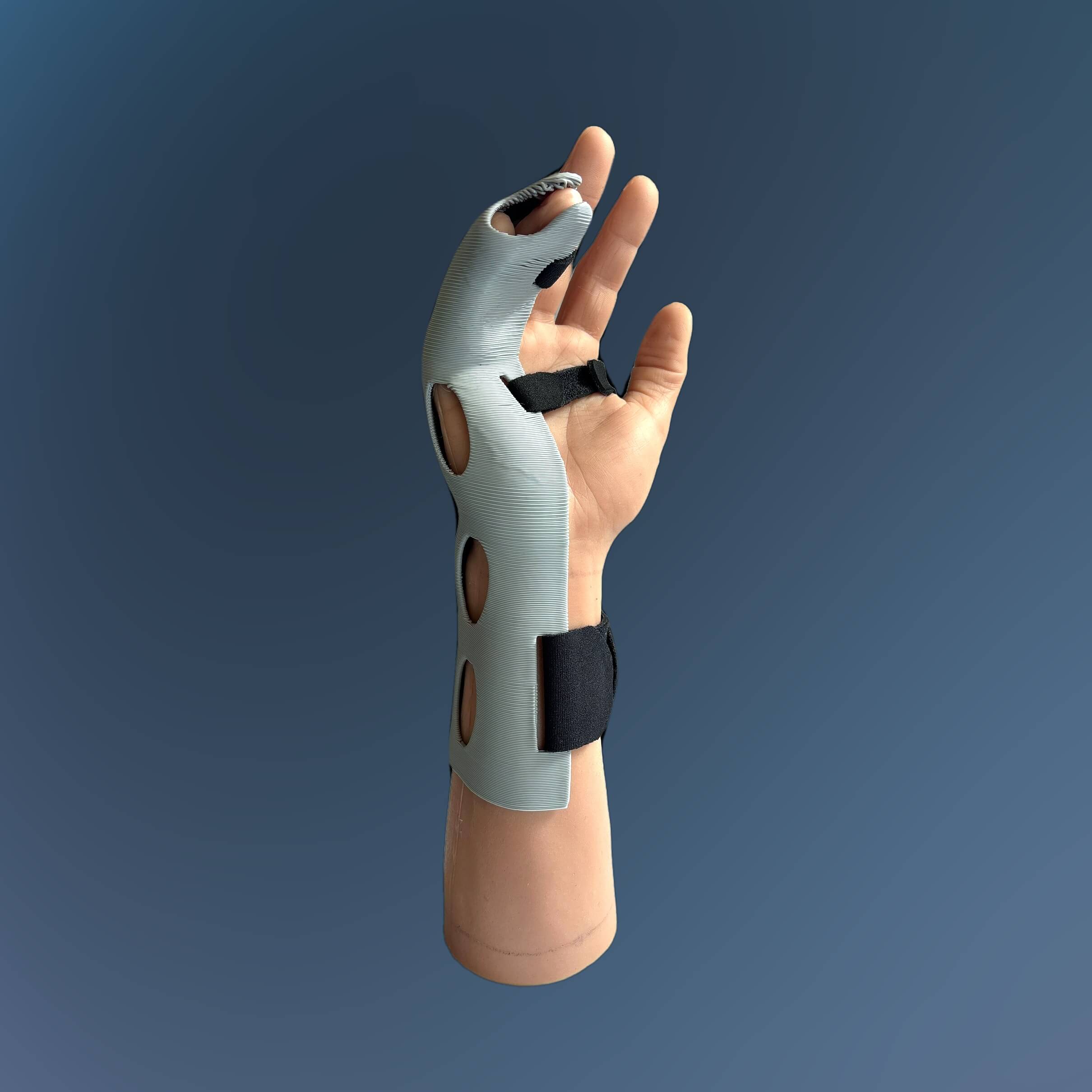 Model Hand Ulnar Gutter Forearm 1