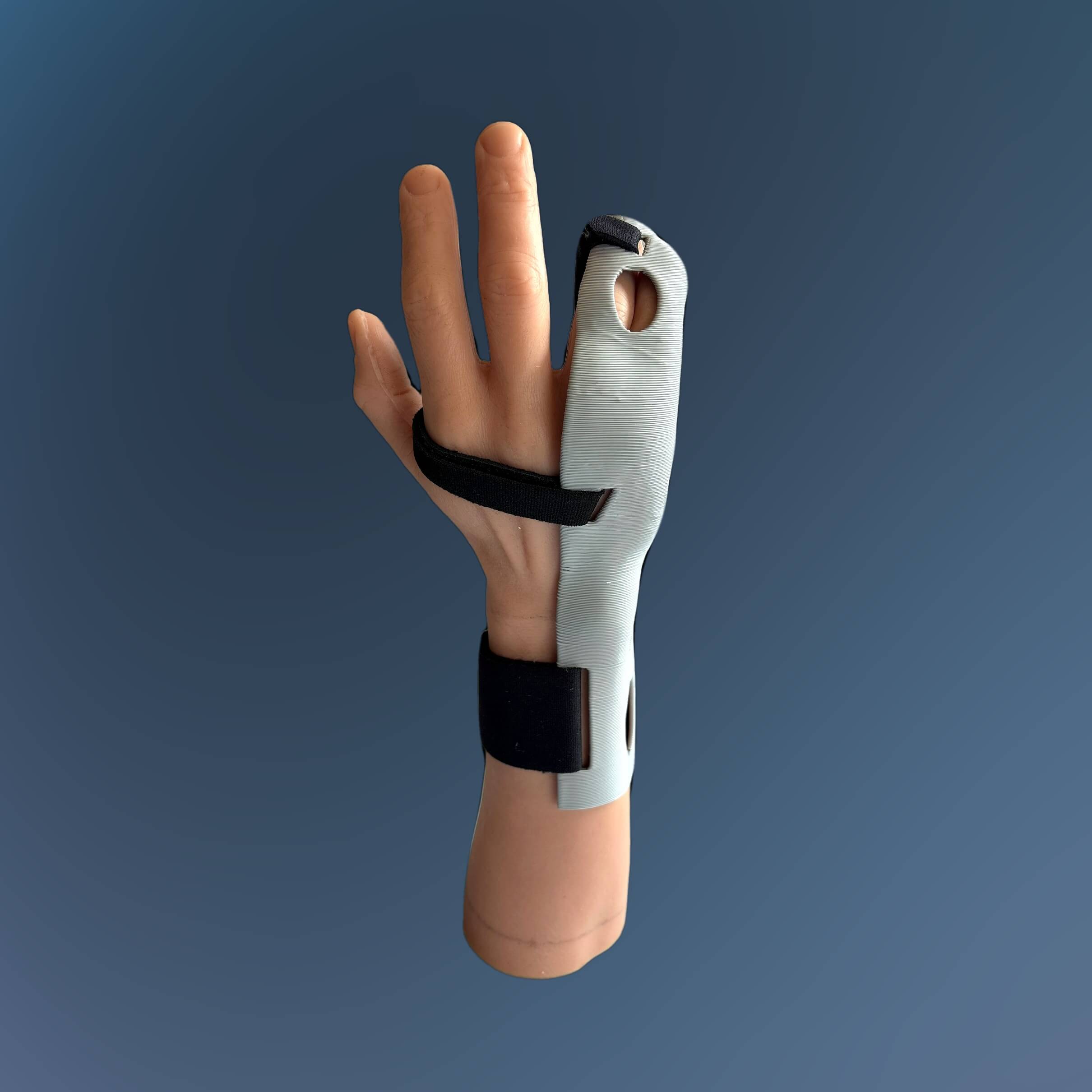 Model Hand Ulnar Gutter Forearm 3