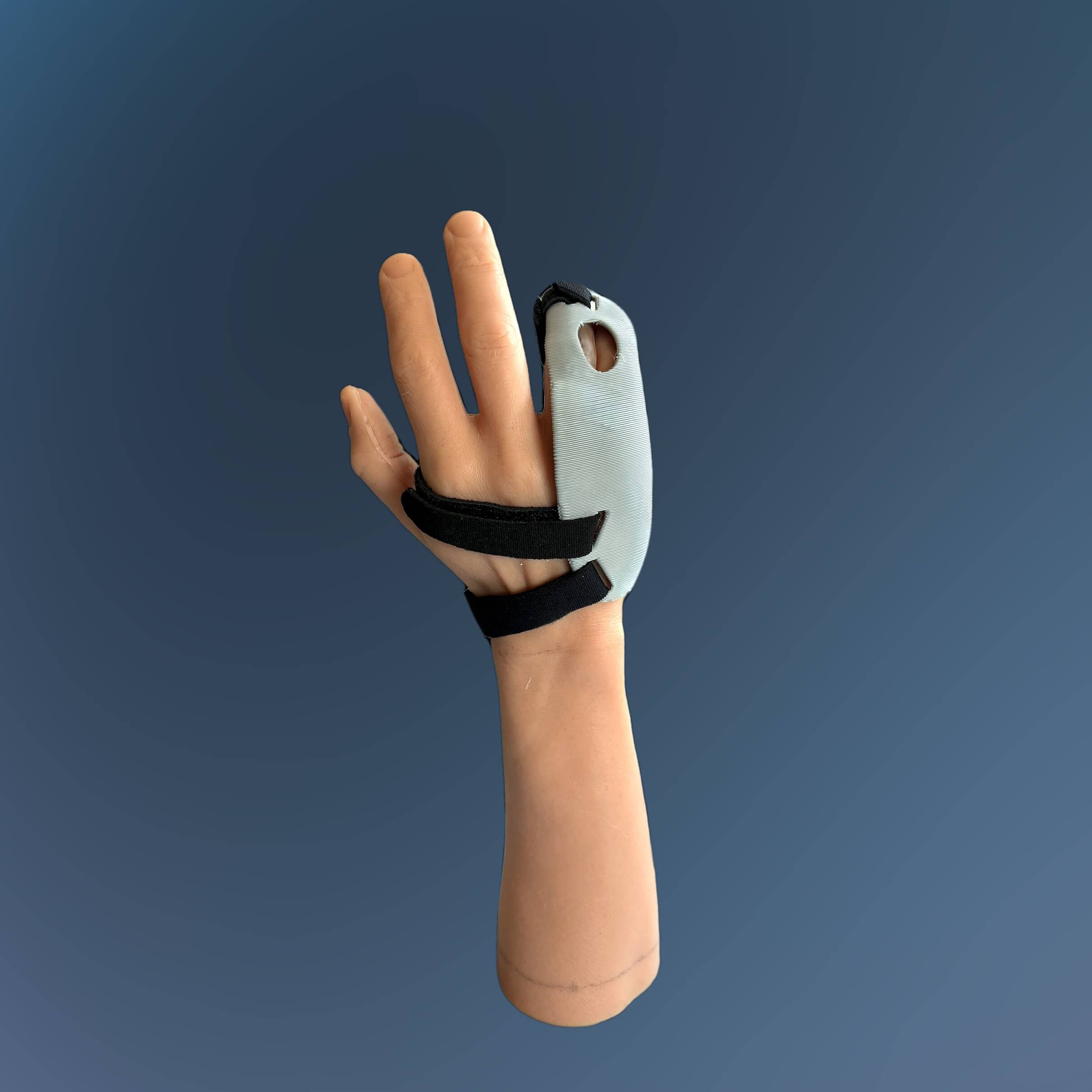 Model Hand Ulnar Gutter Hand 3