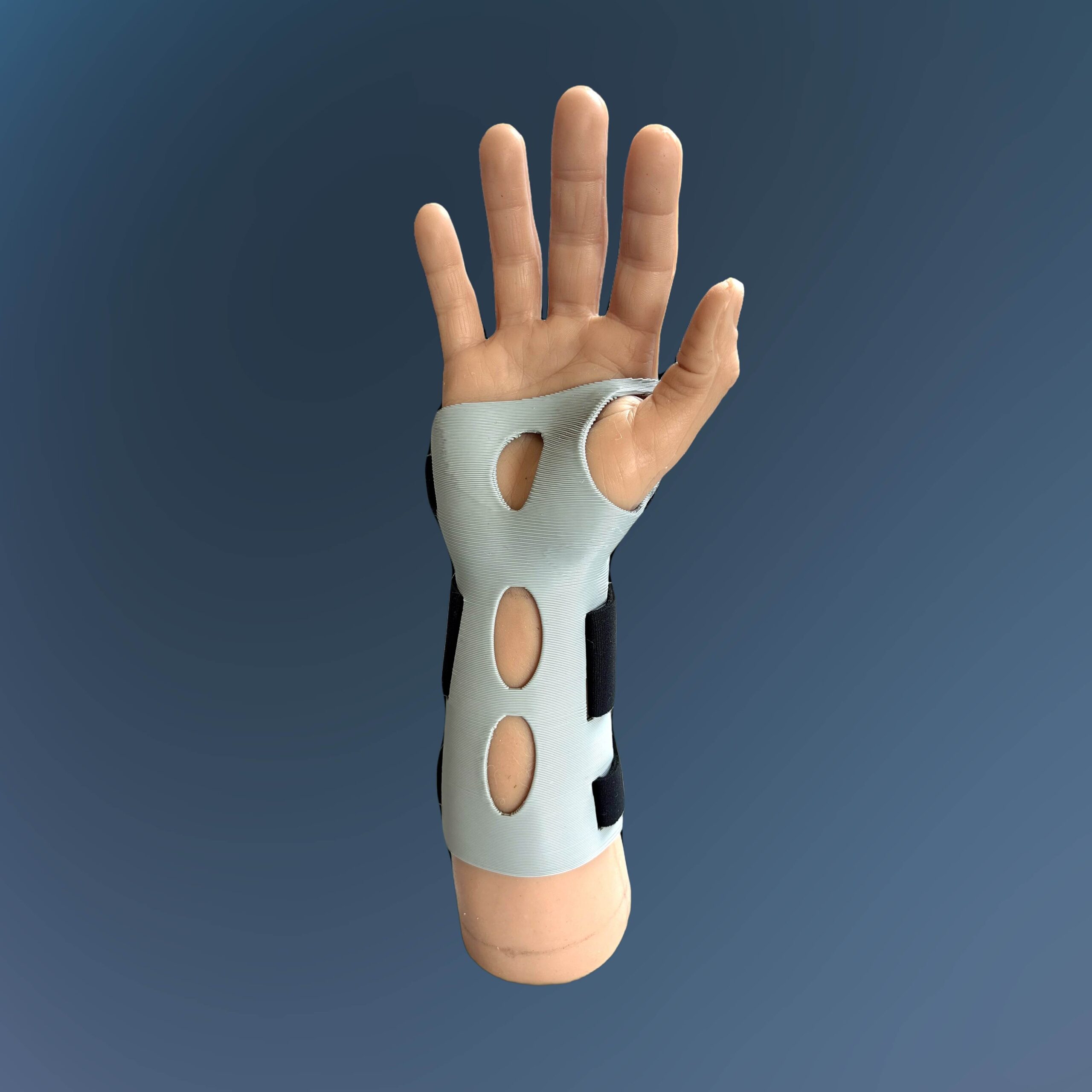 Model Hand Volar Splint 2