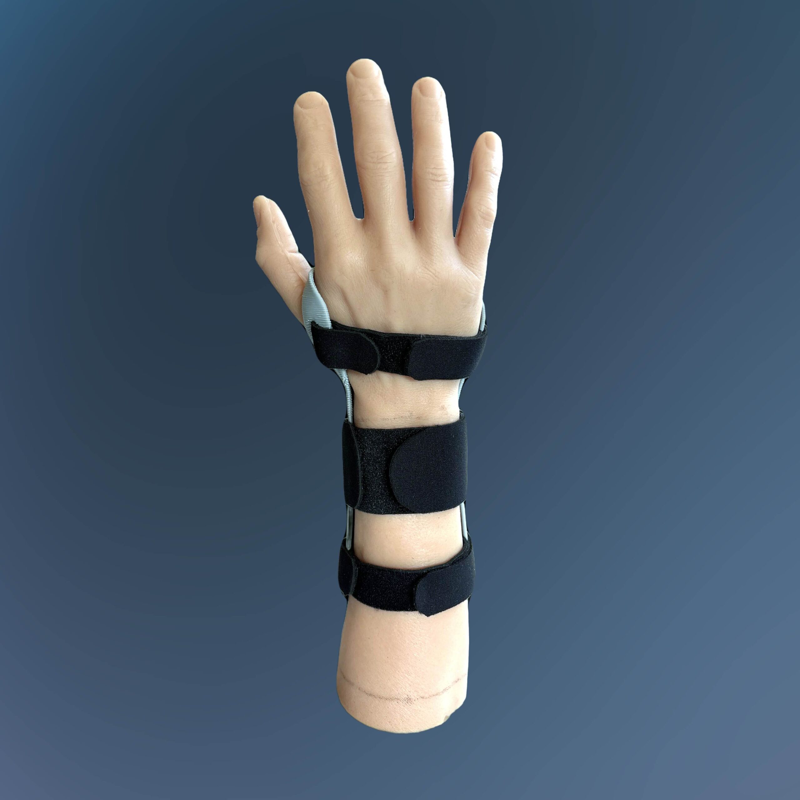 Model Hand Volar Splint 3